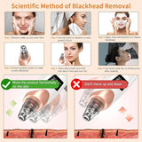 MYBAE  Blackhead Remover “Comes with a Warranty”